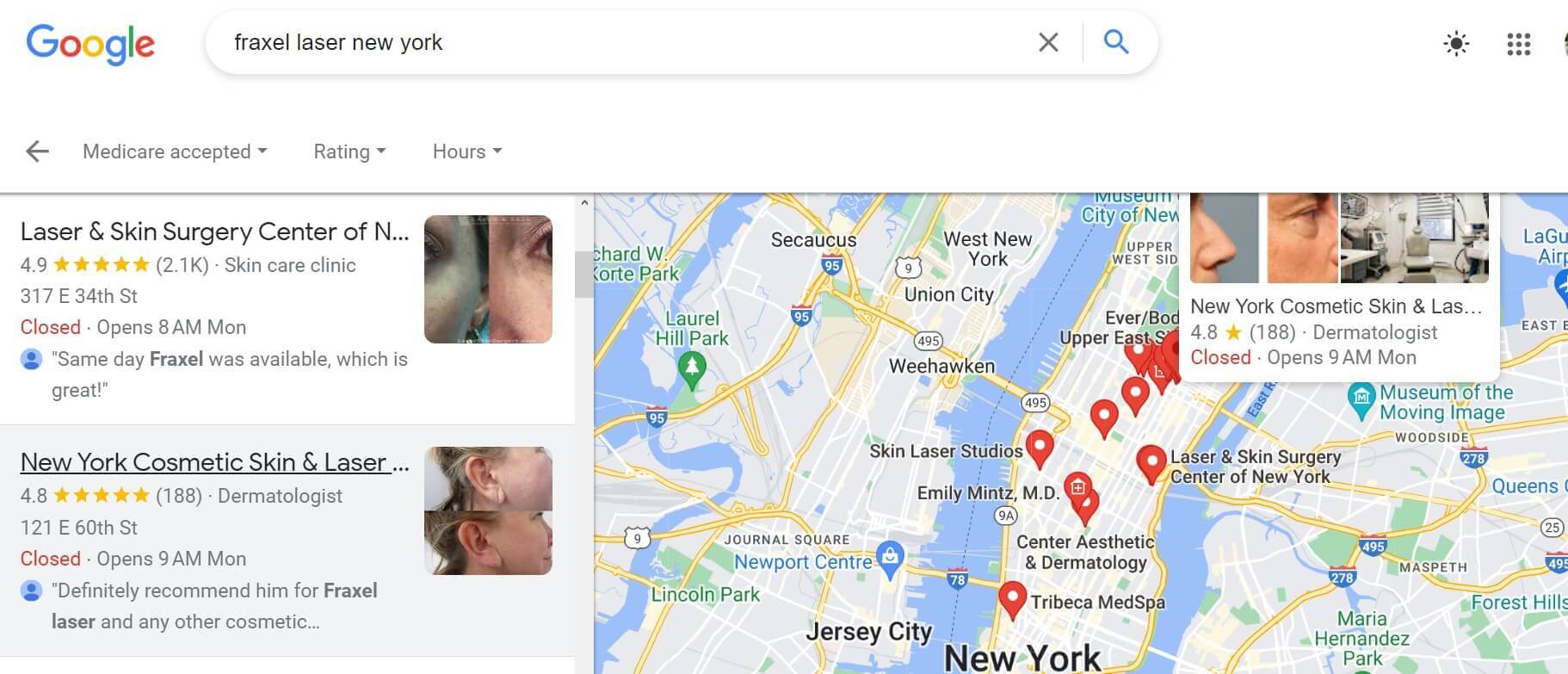 Google Business dermatologist account optimization in New York